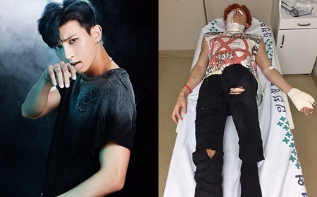 Nam thần tượng Kpop bị bỏng nặng khi đang quay MV mới