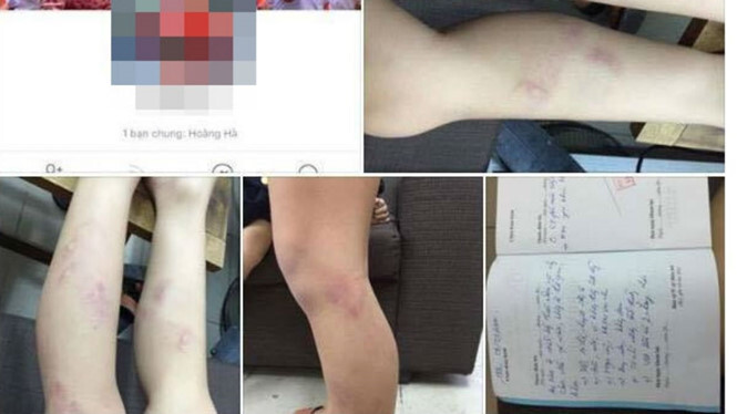 Chủ tịch Hà Nội yêu cầu làm rõ vụ giáo viên đánh 11 học sinh