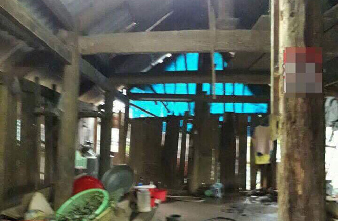 Sức khỏe cháu bé bị mẹ bạo hành, ép uống thuốc trừ sâu tiến triển tốt