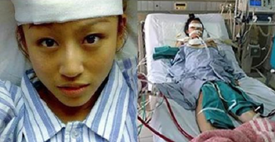 Nữ sinh 22 tuổi qua đời vì ung thư gan: Người trẻ cần phải sửa ngay những thói quen xấu!