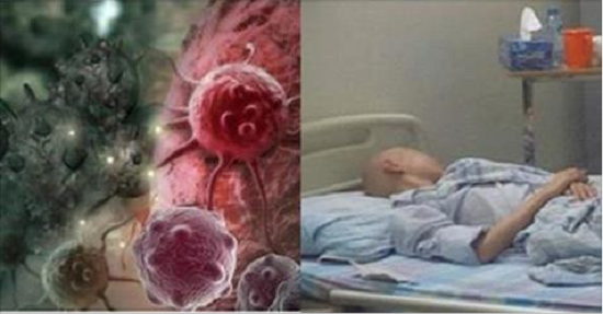 Nếu sáng ngủ dậy đau bụng hoặc có triệu chứng sau, bạn nên khẩn trương đi khám ung thư