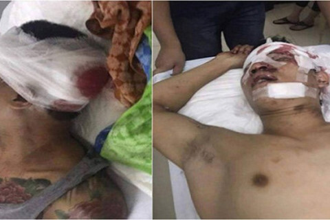 Điều tra vụ hai thanh niên bị đánh trọng thương ở quán bia