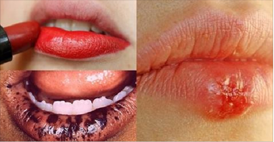 Danh tính các thỏi son nhiễm chì nặng nhất mà các bạn gái nhất định phải biết