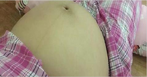Mẹ bầu và những cảnh bảo dễ dẫn đến bong nhau thai non