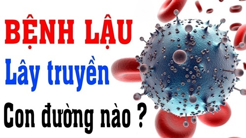 Những con đường lây nhiễm bệnh lậu mà bạn không ngờ tới