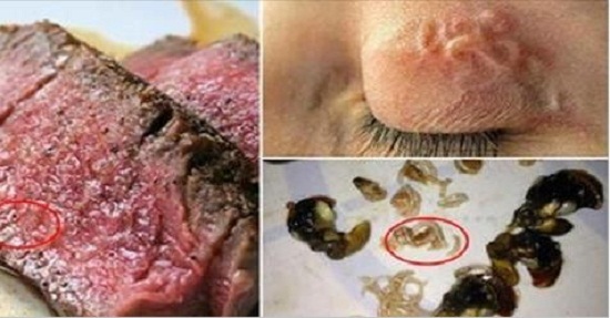 Cảnh báo những món ăn chứa ký sinh trùng có trong bữa cơm người Việt