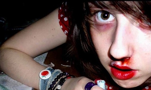 Bộ Y tế cảnh báo: Người nghiện ma túy tổng hợp hiện vô phương cứu chữa