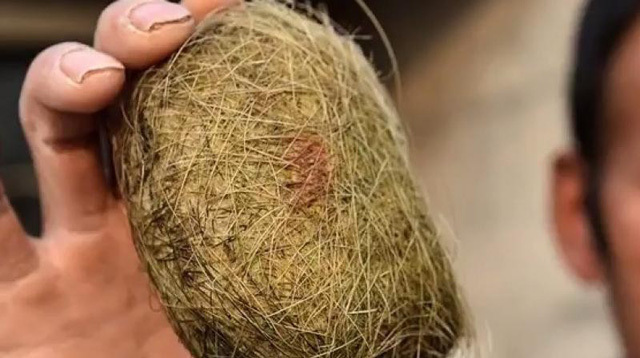 Lão nông dân trở thành tỷ phú sau một đêm nhờ lợn nhà có sỏi mật