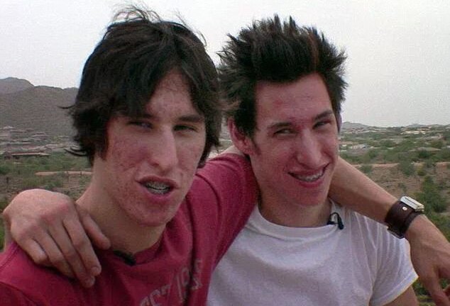 Hai anh em sinh đôi chi nửa tỷ đồng để gọt mặt giống Brad Pitt