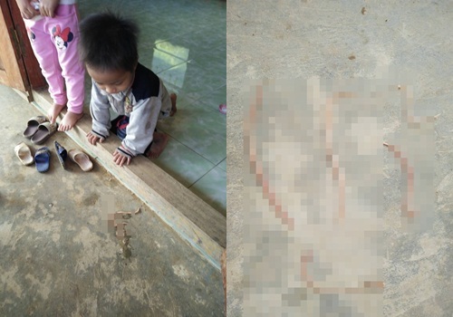 Hãi hùng cảnh học sinh nôn ra giun ngay trong lớp học