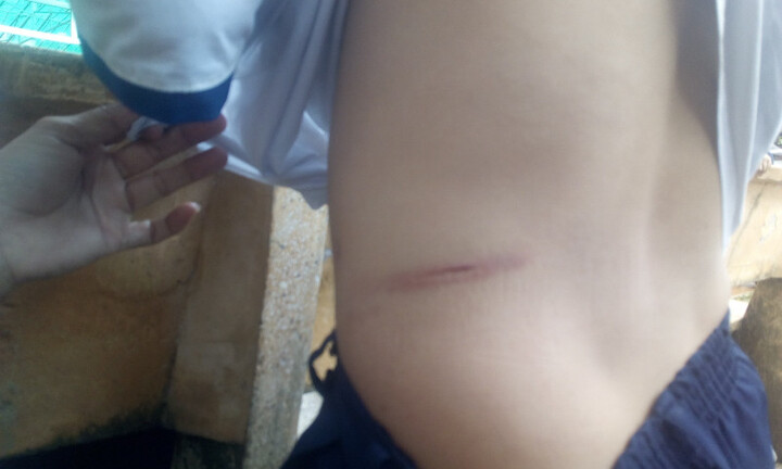 Người cha bạo hành con trai 6 tuổi cam kết không tái phạm