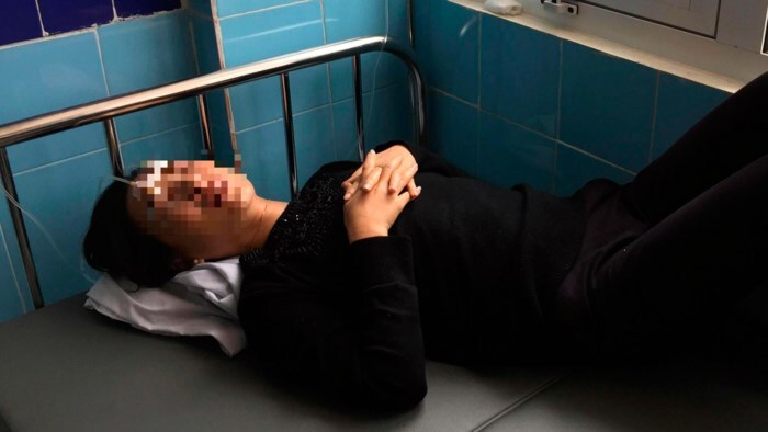 Vụ mẹ chồng tạt axit vào con dâu: Lời kể người chồng