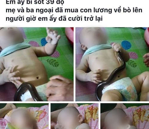 Con nguy kịch vì mẹ tự ý chữa bệnh bằng bài thuốc dân gian truyền miệng