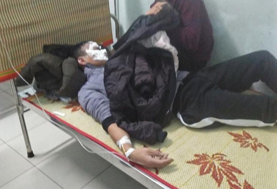 Nam sinh Hà Tĩnh bị bỏng nặng vì dùng bật lửa thử bình xăng