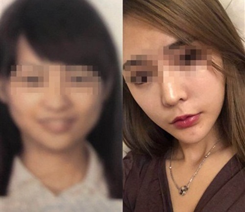 Cô gái trẻ lỡ chuyến bay vì gương mặt sau phẫu thuật thẩm mỹ quá khác lạ