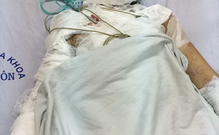 Hoàn cảnh éo le của người phụ nữ bị đổ xăng thiêu ở Hà Nội