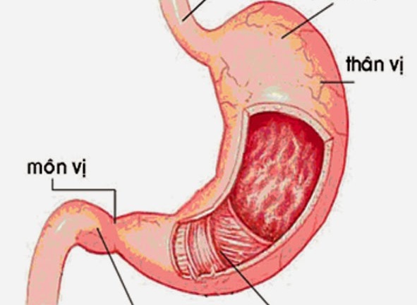 Bệnh viêm hang vị dạ dày có nguy hiểm không?