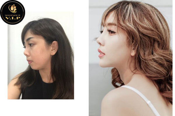 Tôi làm đẹp, tôi chứng minh!