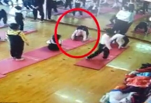Tập Yoga, bé gái 4 tuổi nguy cơ liệt vĩnh viễn