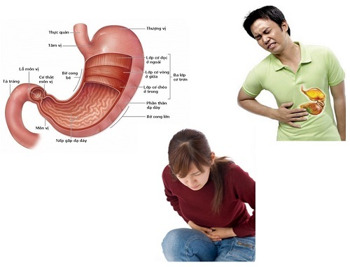 Đau dạ dày cấp tính xử lý như thế nào để không thành mãn tính