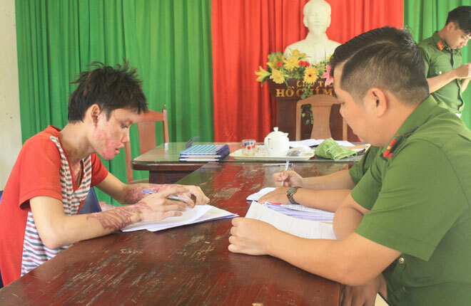 Khởi tố nam thanh niên tạt axit vào người tình rồi tự tử bất thành