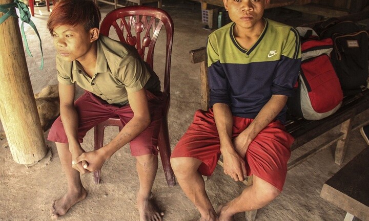 Quảng Bình: Kỳ lạ gia đình nhiều người có 26 ngón tay, chân