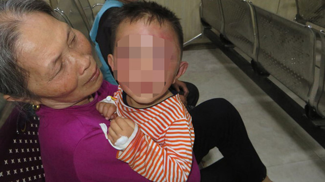 Thông tin bất ngờ vụ bé trai 2 tuổi ở Nghệ An bị bố dượng bạo hành