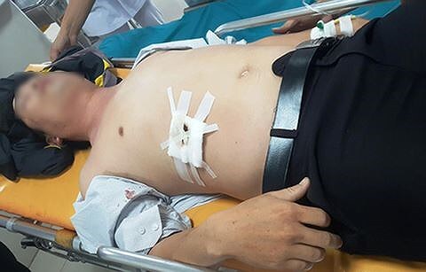 Thầy giáo bị học sinh chặn đường đâm thủng bụng vì nhắc xoá hình xăm