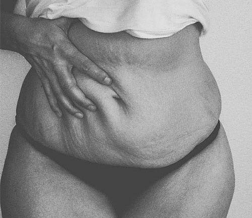 Da xỉn màu sau sinh vì cố giảm cân nhanh