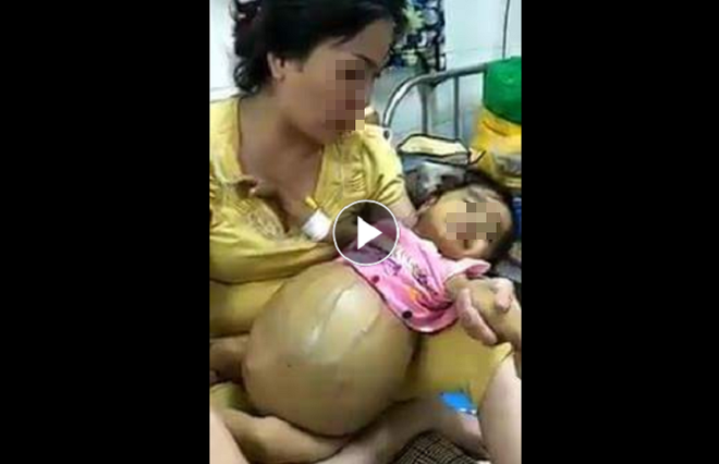 Bé gái ung thư tụy đã mất 3 tháng vẫn bị kẻ xấu đăng ảnh kêu gọi mạnh thường quân giúp đỡ gây phẫn nộ