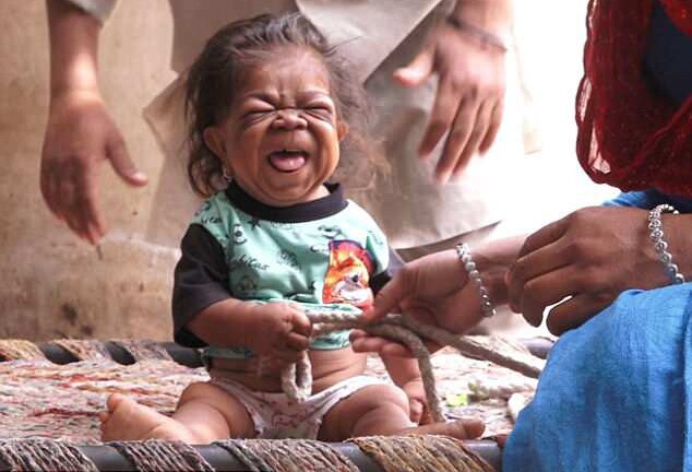 Chàng trai 23 tuổi mắc kẹt trong hình hài của “cậu bé tí hon”