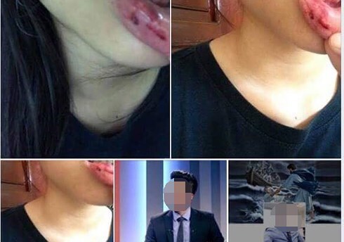 Vụ MC bị tố bạo hành em vợ: Lời tố cáo trên mạng xã hội có được pháp luật thừa nhận?