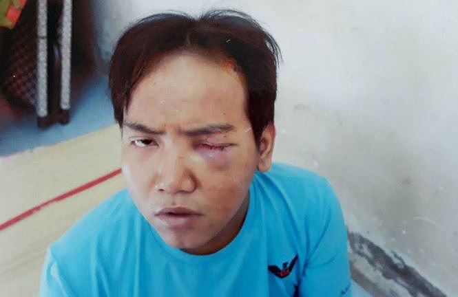 Đình chỉ điều tra vụ bảo vệ dân phố sát hại bé 6 tuổi ở Sài Gòn