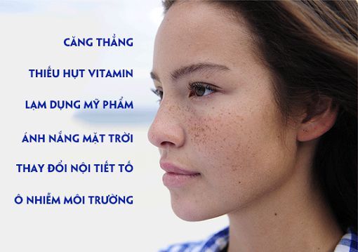 Những bí mật chưa từng hé lộ về giải pháp trị tàn nhang Double White