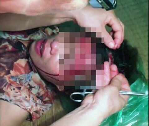 Đi tìm chồng, vợ bị