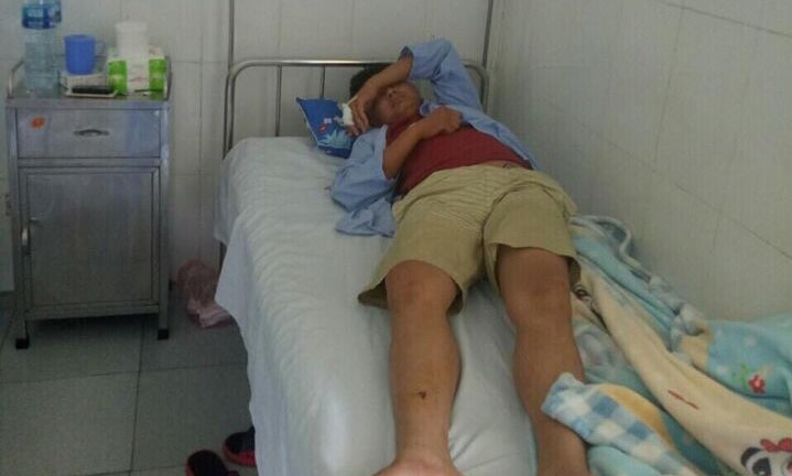 Khởi tố lái xe dùng tuýp sắt đánh hành khách vì để con trớ trên xe