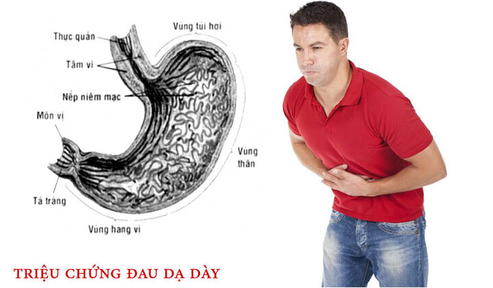 4 triệu chứng đau dạ dày nhẹ cần biết để chữa kịp thời
