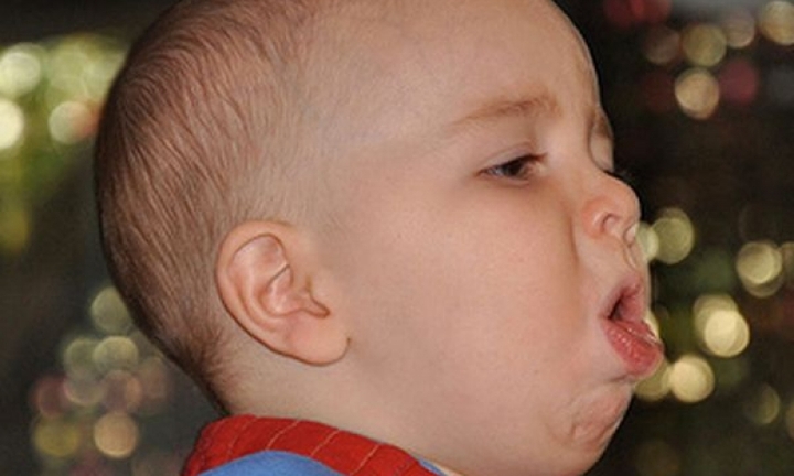 Thận trọng khi sử dụng thuốc ho cho trẻ em, mẹ “ẩu” có thể gây nguy hiểm cho con