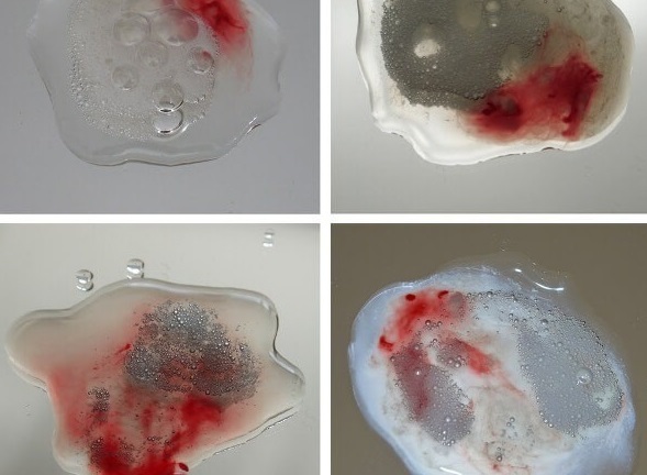 Căn bệnh khiến đàn ông xuất tinh ra máu mỗi khi