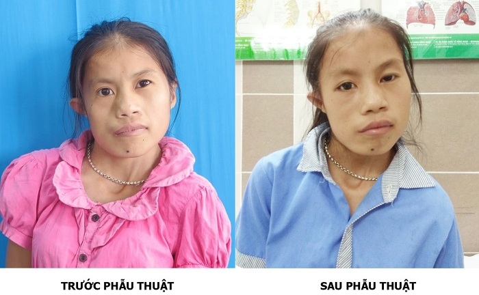Phép màu xuất hiện sau 20 năm cuộc đời của cô gái trẻ Thái Nguyên