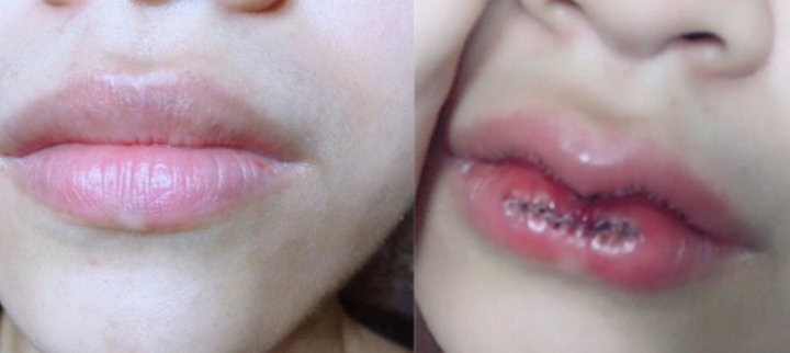 Điều tra vụ thanh niên đâm người ở cơ sở thẩm mỹ vì bạn gái sửa môi không như ý