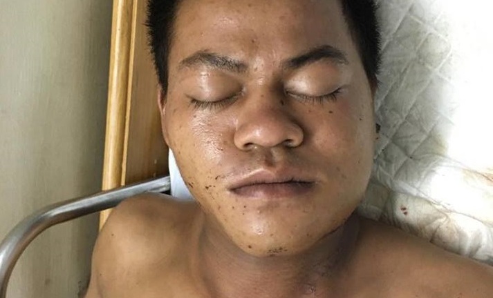 Tìm người nhà bệnh nhân bị ngã, vỡ hàm