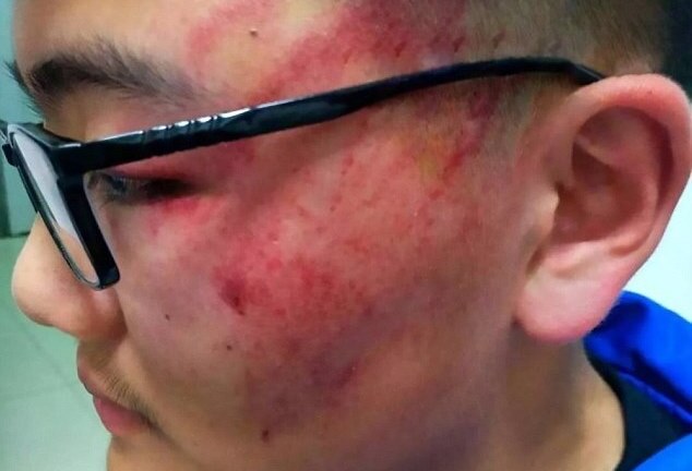 Giáo viên bị sa thải vì tát hằn cả bàn tay trên mặt học sinh 