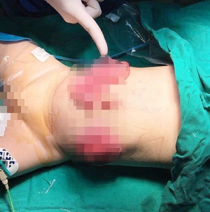 Tin tức đời sống mới nhất ngày 17/7/2018: Mẹ có biểu hiện tâm thần đâm con 11 tháng tuổi