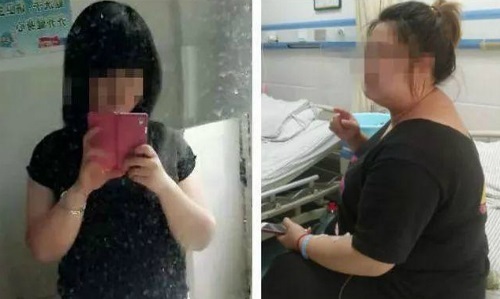 Sau 7 năm uống thuốc giảm béo, thiếu nữ nhận 