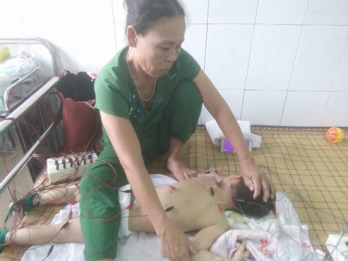 Tin tức đời sống mới nhất ngày 21/7/2018: Mù mắt vì làm đẹp với chất làm đầy