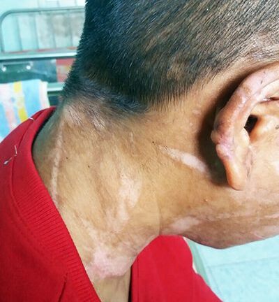 Lời kể đẫm nước mắt của cô gái bị đánh đập tàn nhẫn chạy chốn khỏi 