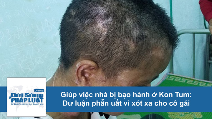 Vụ cô gái trẻ bị bà chủ bạo hành ở Gia Lai: Dư luận phẫn uất, xót xa