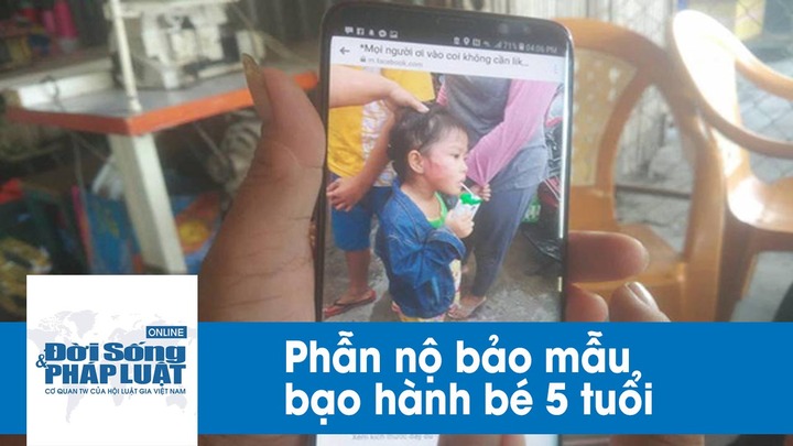 Toàn cảnh vụ bảo mẫu tát bé gái 5 tuổi nứt xương hàm