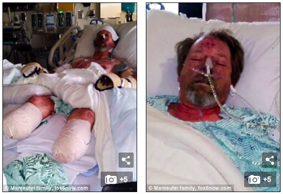 Để chó cưng liếm, người đàn ông phải cắt bỏ cả chân tay